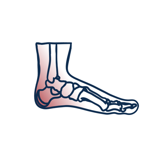 Arthrite, Arthrose, Rhumatisme