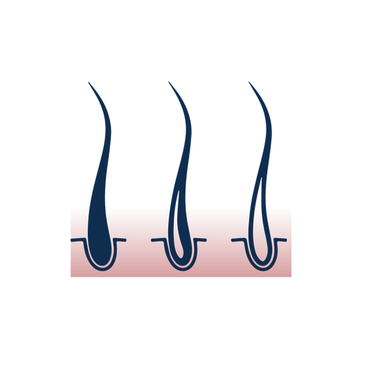 Chute De Cheveux