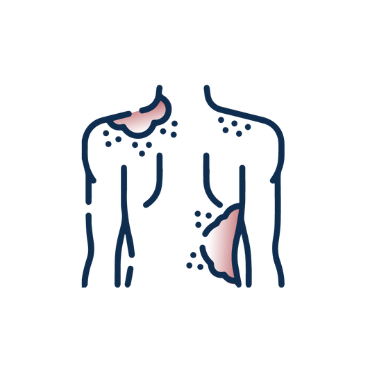 Mycoses
